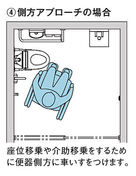 トイレ側方アプローチ